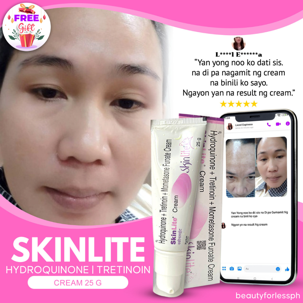 AUTHENTIC PREMIUM SKINLITE MELASMA WHITENING CREAM ANTI AGING, ANTI ...