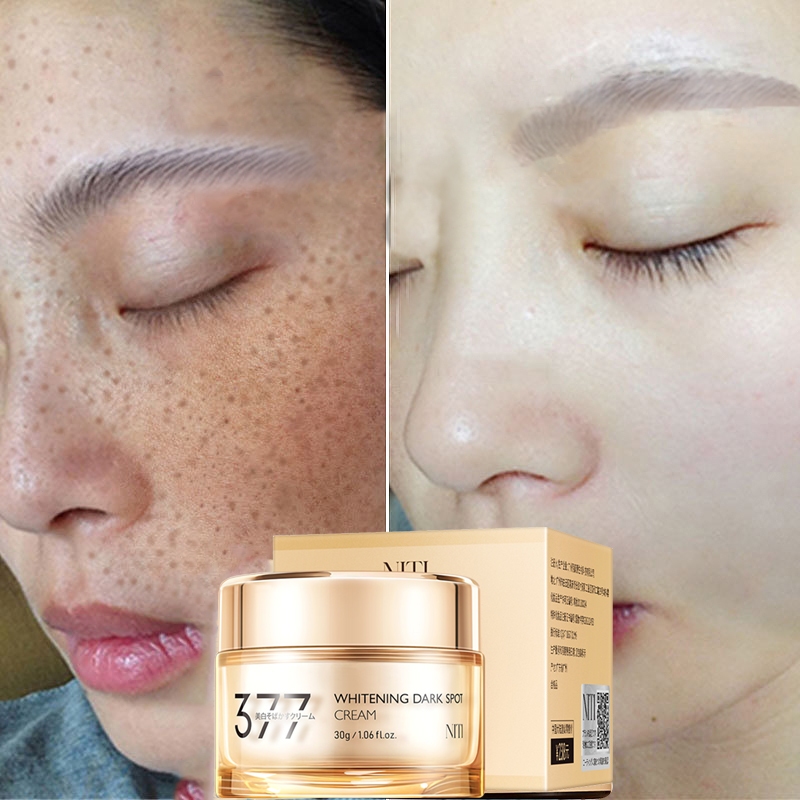 Niacinamide Whitening Cream Sunburn Freckle Removing cream High