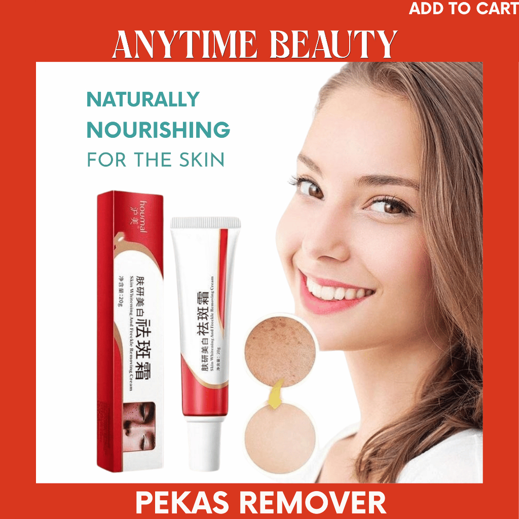 Original Melasma Cream Pekas Remover - Effective Dark Spot Remover ...