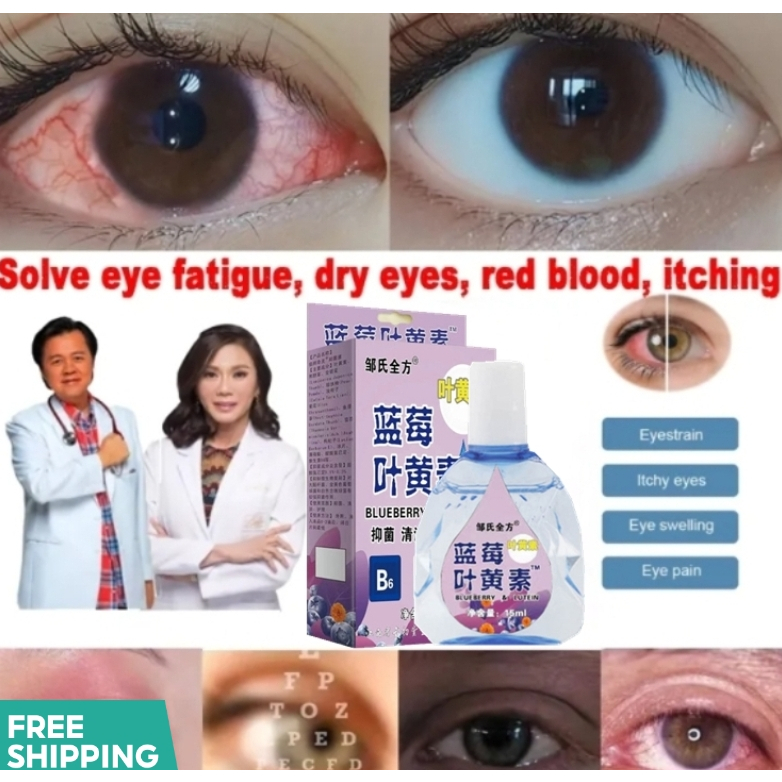 Blueberry Eye Drops 15ML For Dry Eyes Itchy Relieves Red Eyes ...