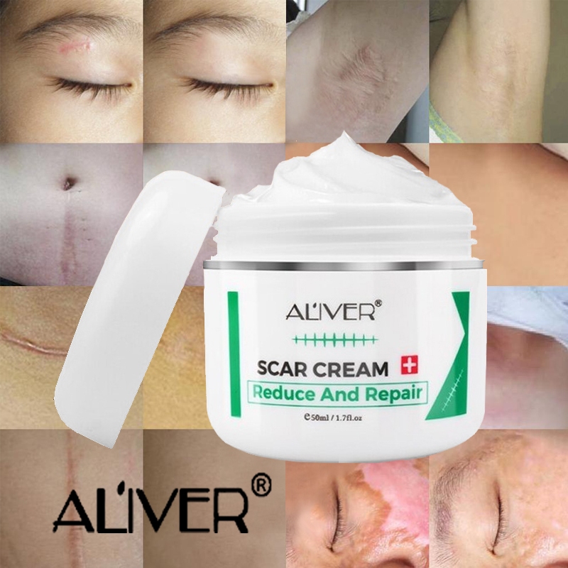 Aliver Scar Cream Old Scar Removal Gel Repair Stretch Marks, Pimple ...