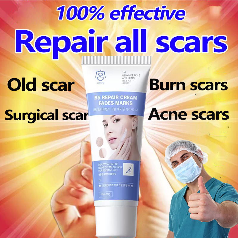 Scar Removal Cream Old Scar Remover Nourishing Moisturizing Skin Scar ...
