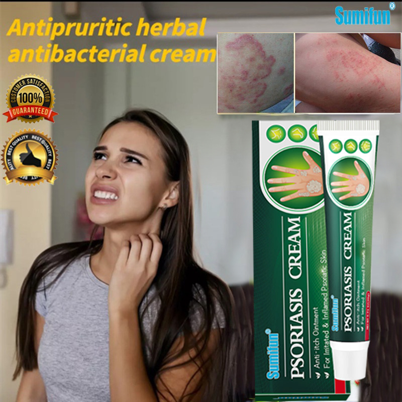 Psoriasis Eczema Cream Antibacterial Skin Fungal Infection Fast Itch ...