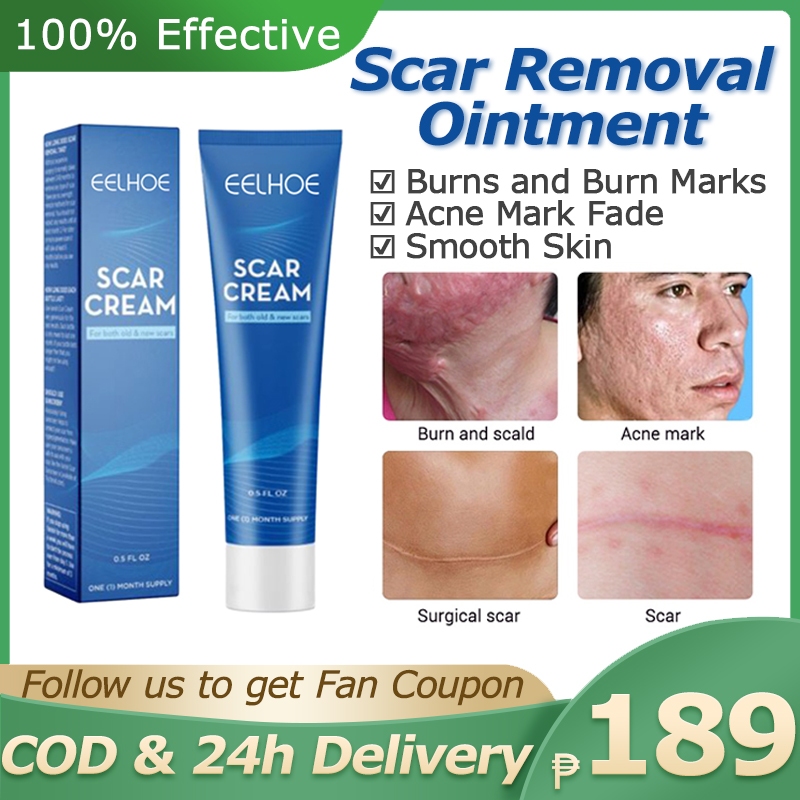 Scar Removal Cream Acne Scar Remover Stretch Mark Scald Burns Treatment ...