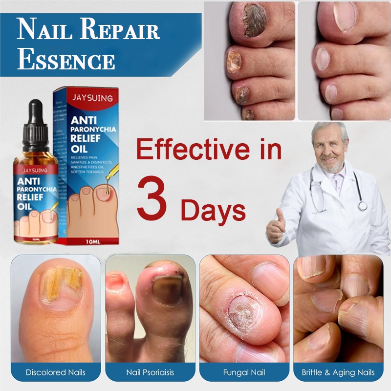 Nail Repair Essence Fungal Treatment Nail Cuticle Repair Onychomycosis