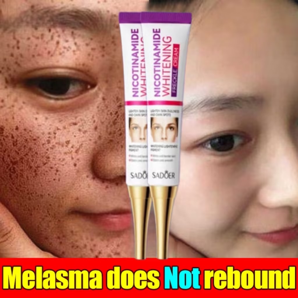 Whitening Anti Freckle Cream Nicotinamide Remove Dark Spot Melasma Moisturizing Anti Aging G