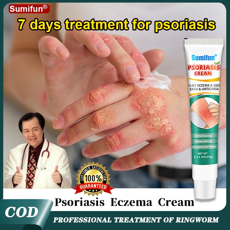 Antibacterial Cream Anti Itch Relief Psoriasis Eczema Rash Itchy Skin