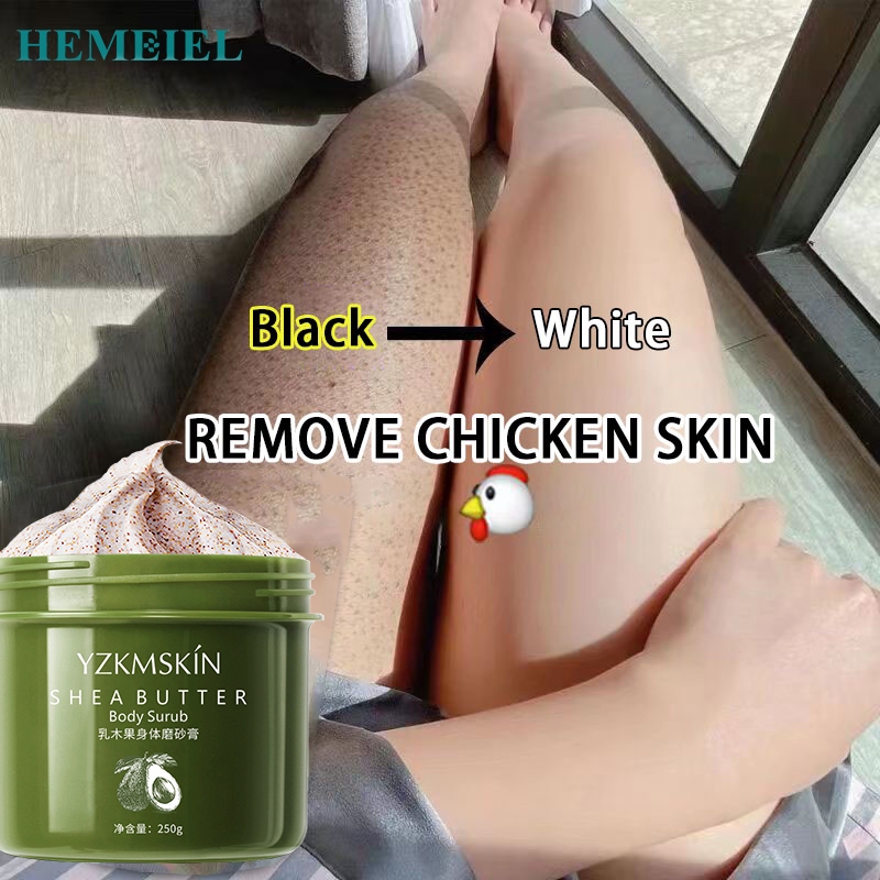 HEMEIEL Body Scrub Whitening/Exfoliating Scrub/Pimples Remover