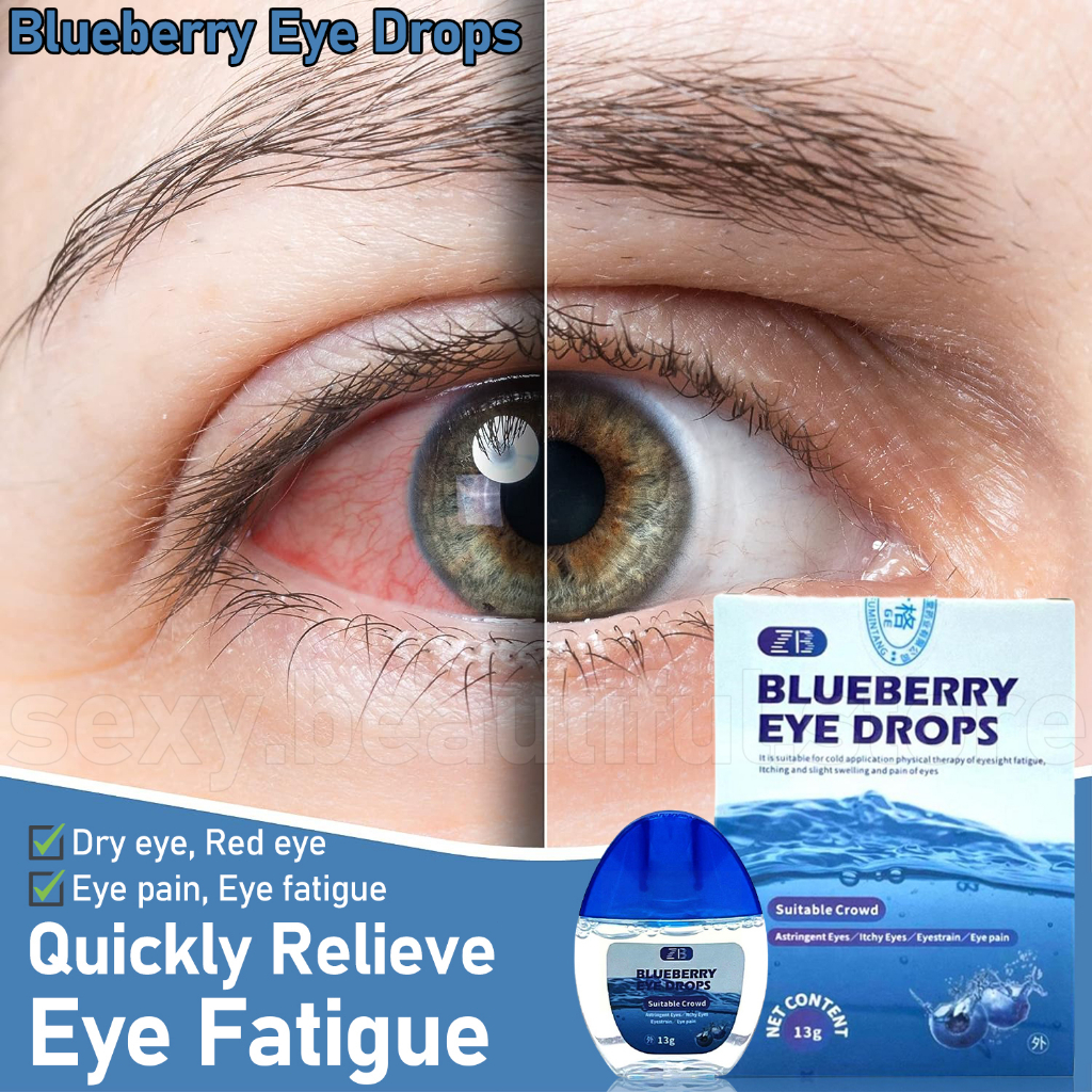 COD Blueberry Eye Drops Itchy Eyes Eye Drops Dry Eyes