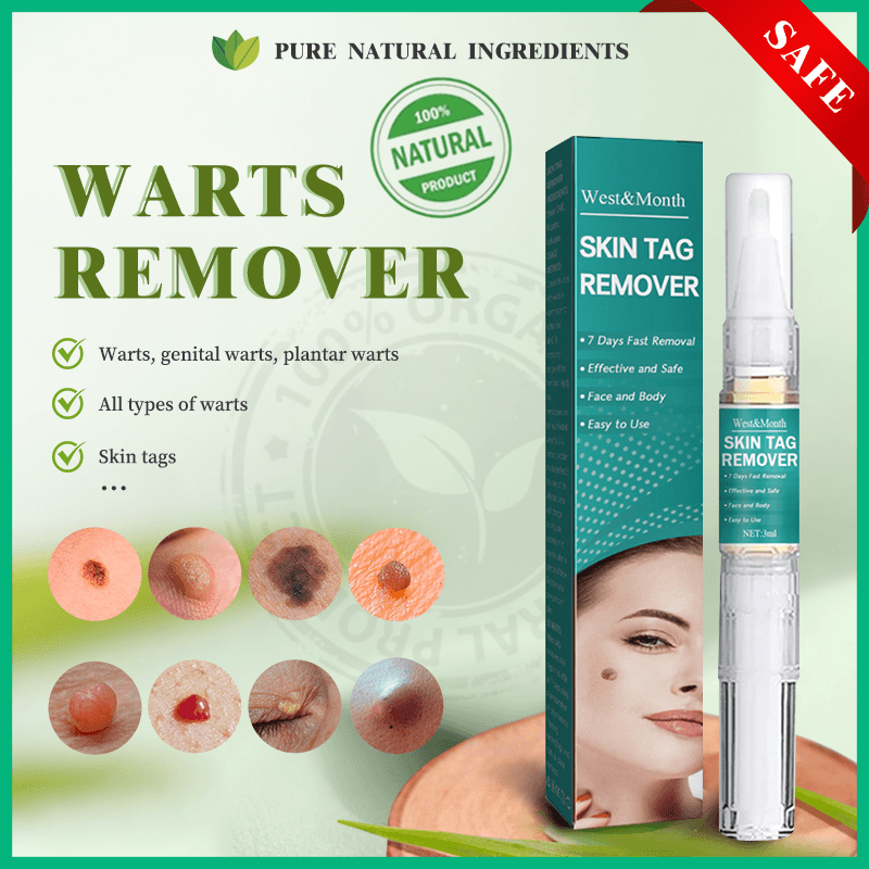 Warts Kasoy Remover Cream Skin Tag Mole Cream Remover Original Warts ...