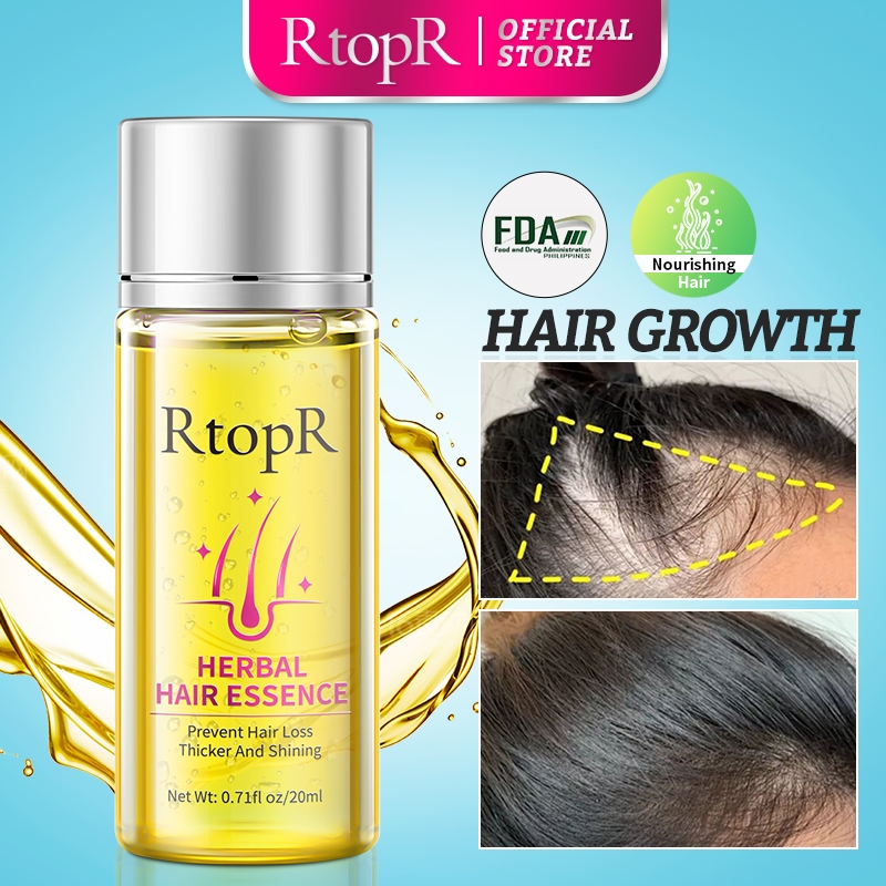 RtopR Hair Growth Essence Anti Hair Loss Liquid Promote Thick Fast Hair ...