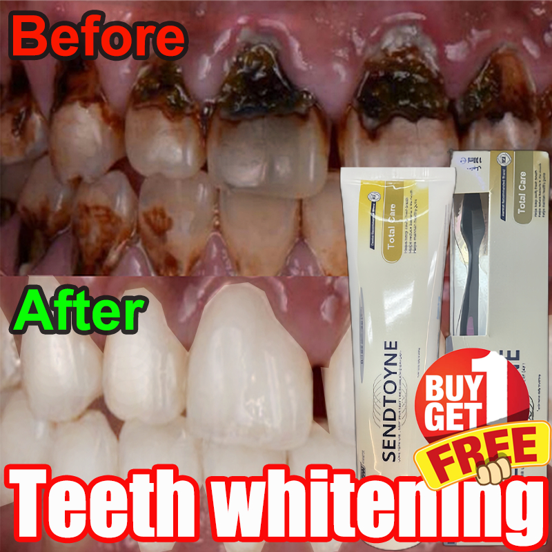 Toothpaste Whitening Teeth Remove Tartar Eliminate Bad Breath Odor ...