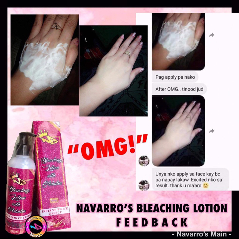 NAVARRO’s BLEACHING LOTION ORIGINAL Shopee Philippines
