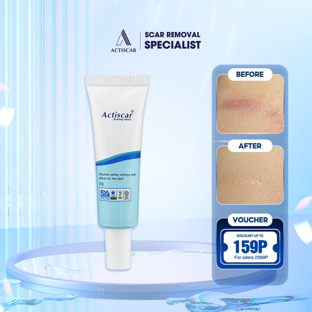 Actiscar Scar Removal Cream 20g Helps to Remove Keloid, Dimple, Potted, Chickenpox Scars