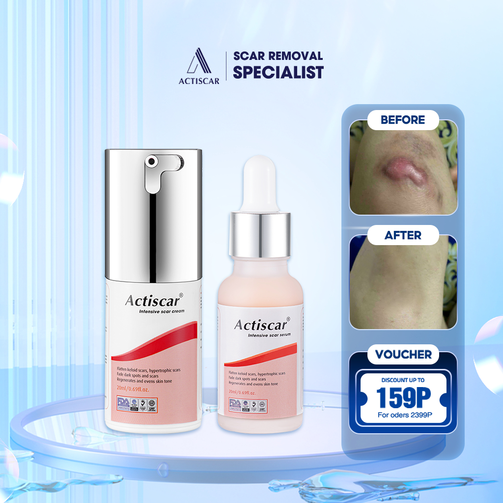2] Actiscar Scar Removal Cream And Serum Prevents Keloids