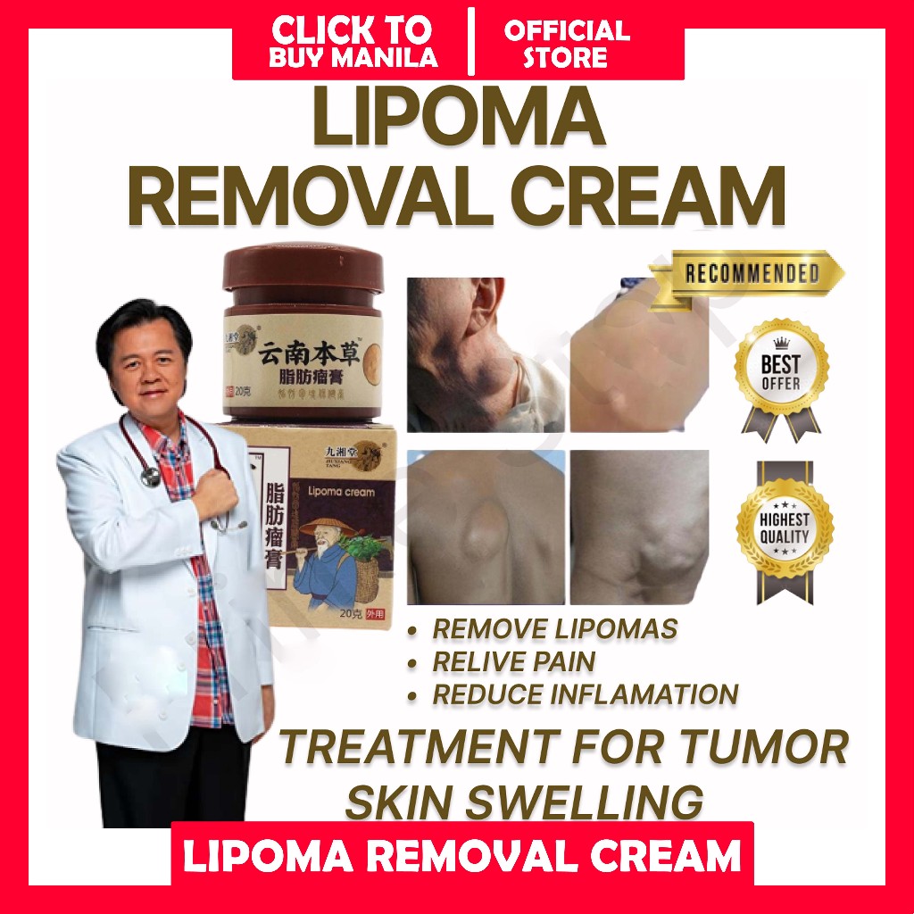 Original Lipoma Removal Cream Original Treat Tumor Skin Swelling Ointment Herbal Natural Lipoma 