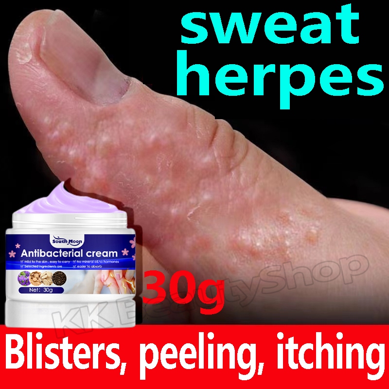 Eczema Cream Effective Itching Sweat Herpes Treatment Mosquito Bite
