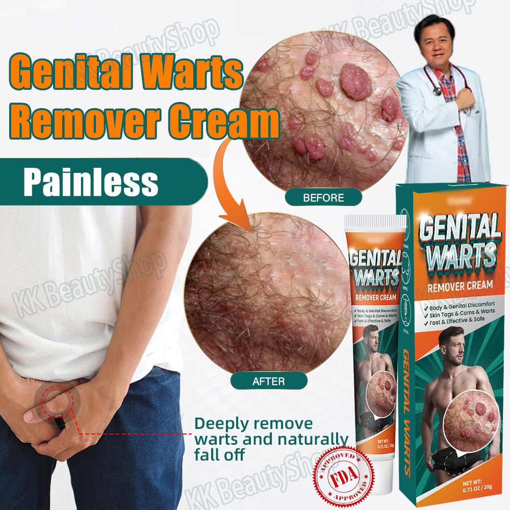 Genital Warts Remover Cream Private Herpes Genital Condyloma Health