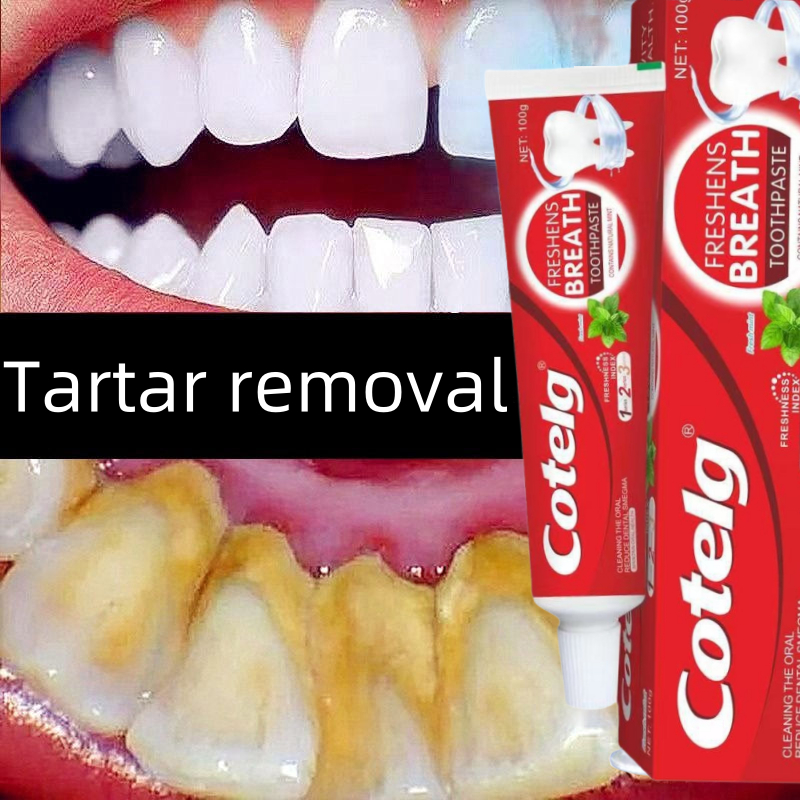 BUY 1 TAKE 2 Whitening Toothpaste Effectively Remove Dental Plaque ...