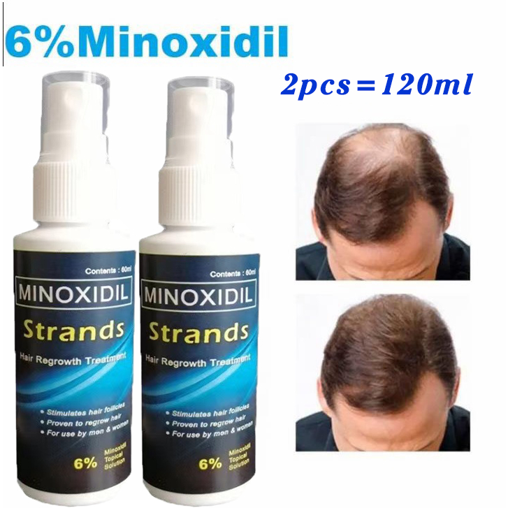 【original imported】Minoxidil Strands 6% 100% authentic Minoxidil ...