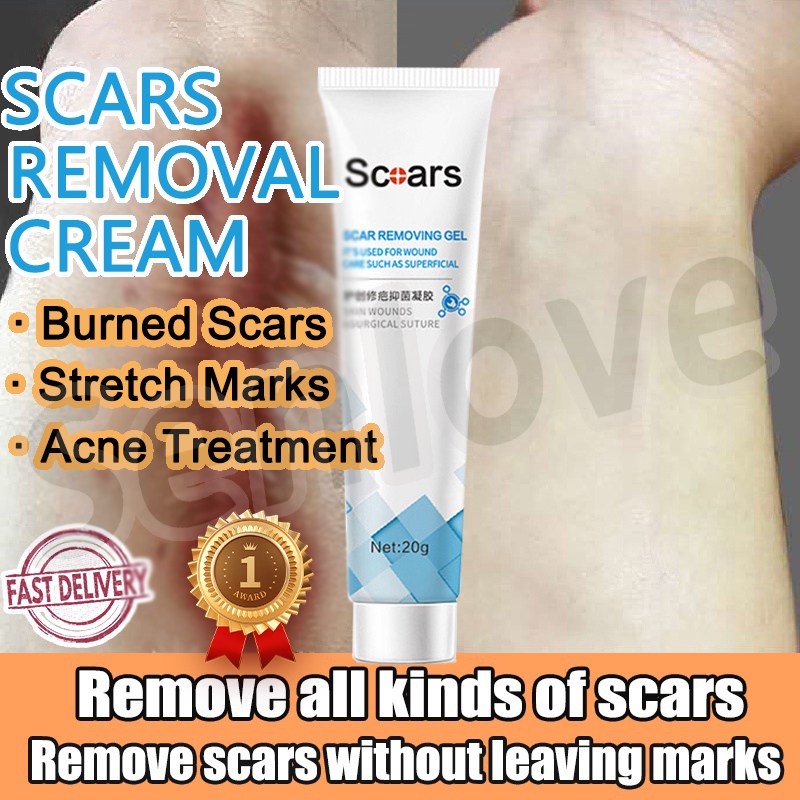 SENLOVE Scar Removal Cream Peklat Remover Acne Treatment Scar remover ...