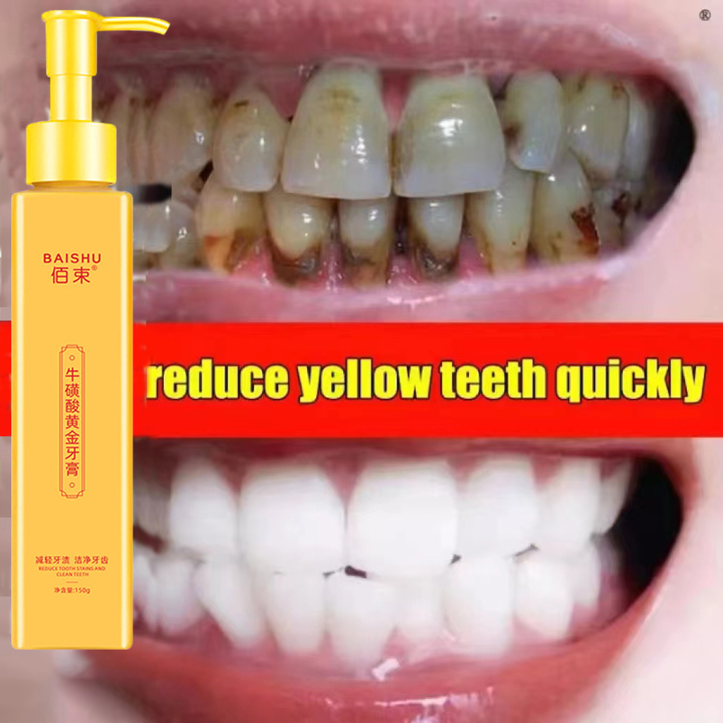 Teeth whitening Whitening toothpaste White teeth Teeth clean dirt Bad ...