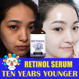 Shop meebak retinol serum for Sale on Shopee Philippines