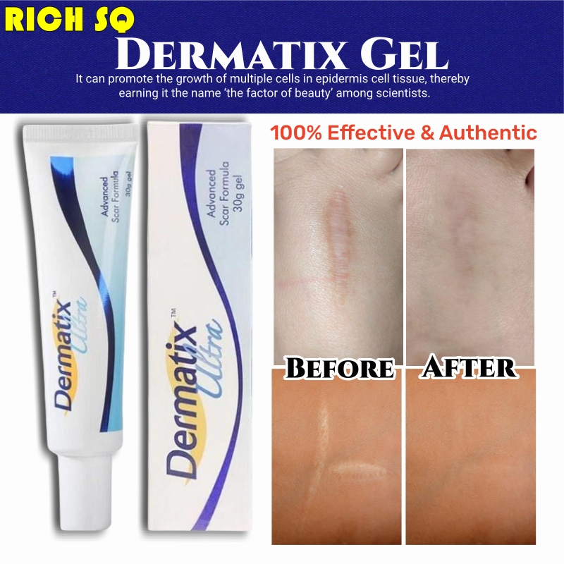 Effective Dermatix Scar Removal Cream Scar Gel Acne Scars Treatment Old Scar Remover Scar Repair