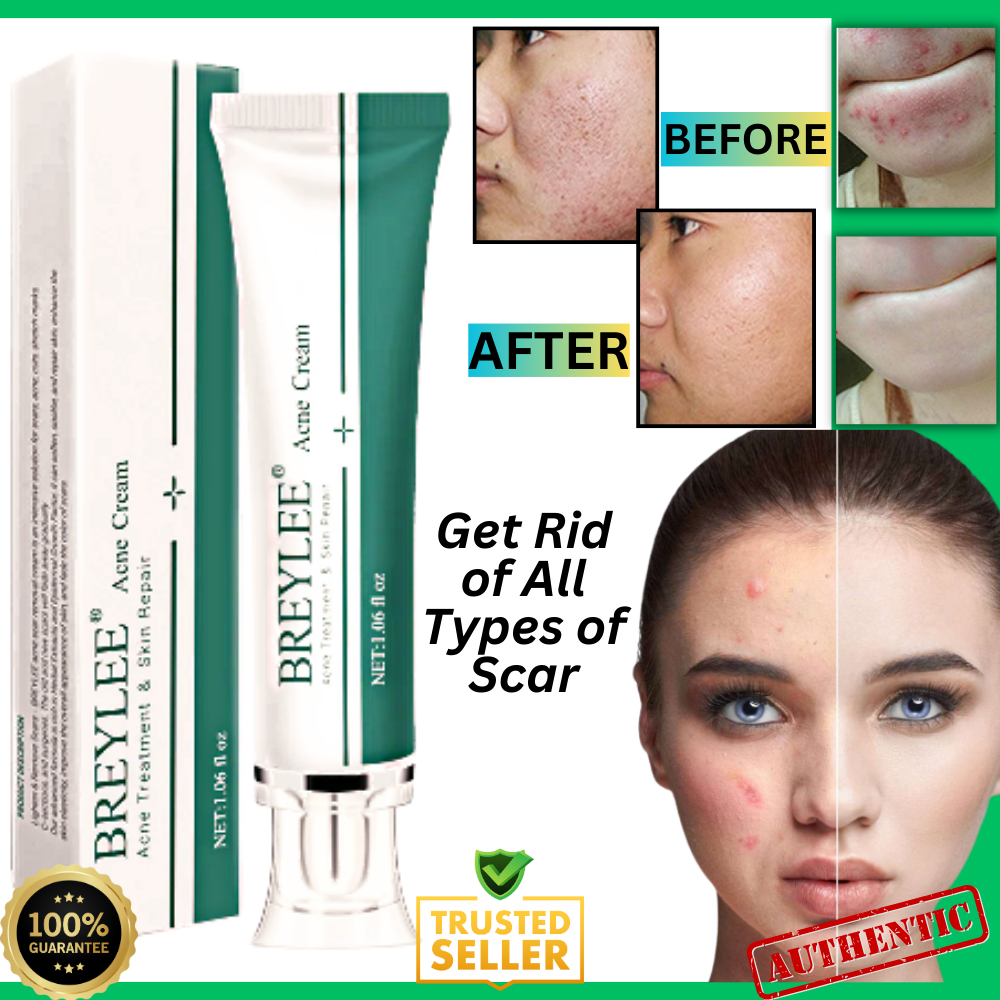 Advanced Acne Remover & Scar Solution for Peklat, Pimple, and Stretch ...