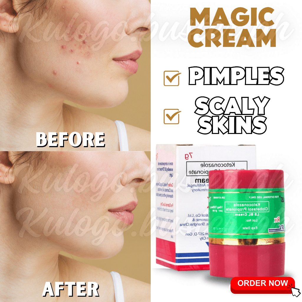 CAUSEDIAPER IRRITATION CREAM MAGIC CREAM DAY AND NIGHT ACNE DRYROUGH