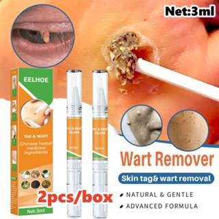 12pcs 3ml Wart Remover Pen Skin Tag Mole Remover Eliminate Foot Corn Warts  Cream