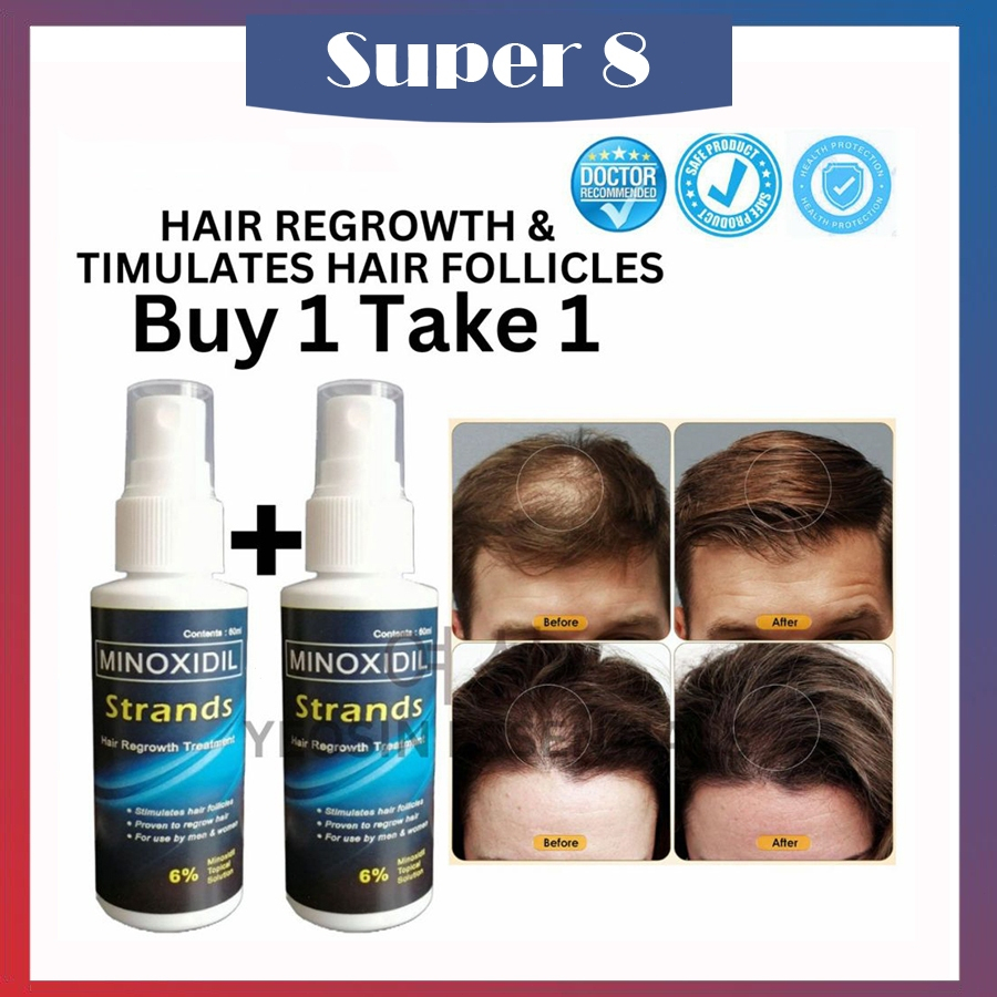 Men Hair Grower Spray Minoxidil Strands 6% Topical Solution (60ml per ...