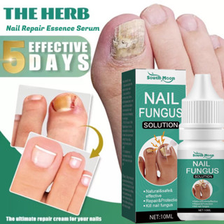 Nail Fungus Treatment Original Nail Anti Fungal Treatment Nail Fungus 