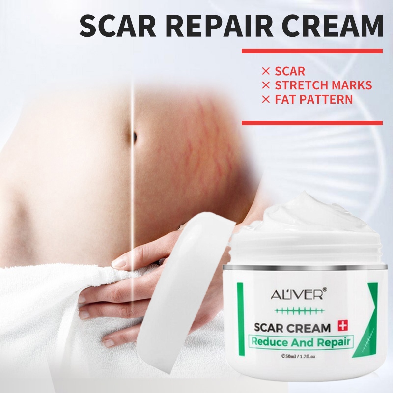 Aliver Old Leg Scar Remover Scar Repair Cream Remove Facial Acne 50ml Repair Stretch Mark Scars 6144