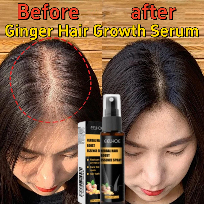 Hair Loss Treatment For Women Hair Growth Spray With Ginger – 30ml