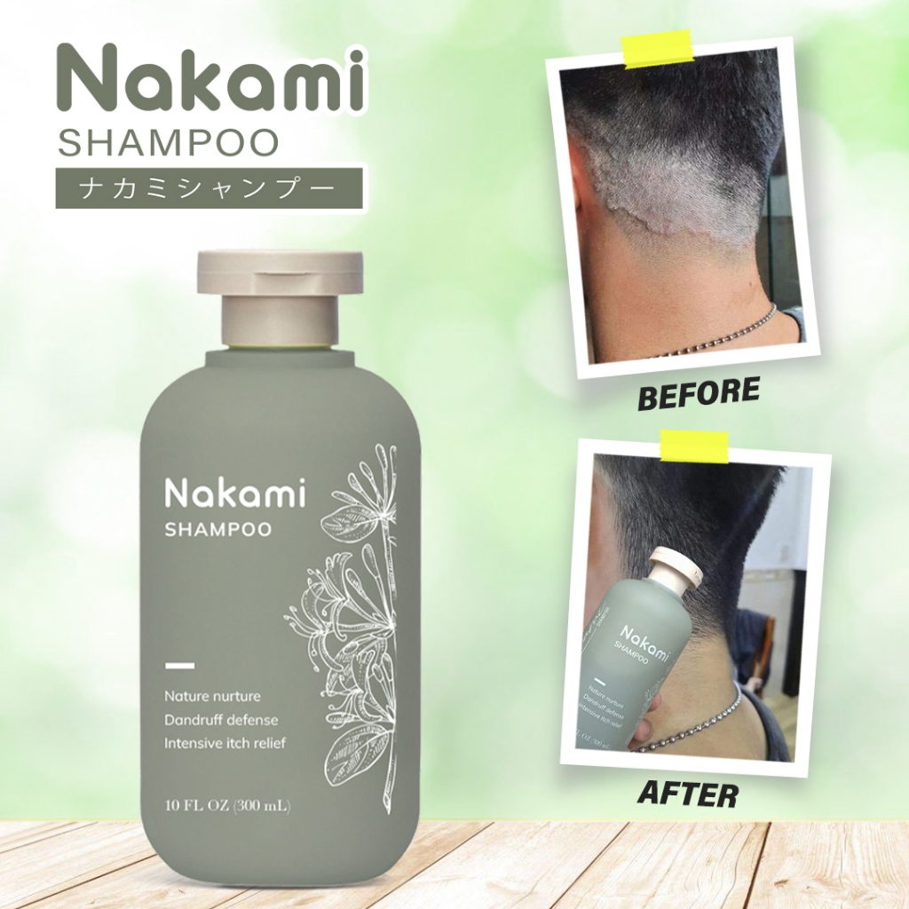 Sakura Japan AntiDandruff Shampoo Original 300mL AntiFungal Anti