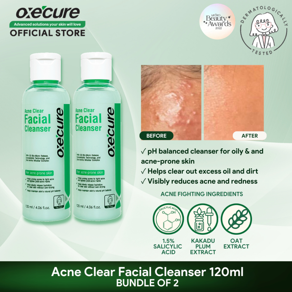 OXECURE 1.5 Salicylic Acid Acne Clear Facial Cleanser 120ml Bundle of