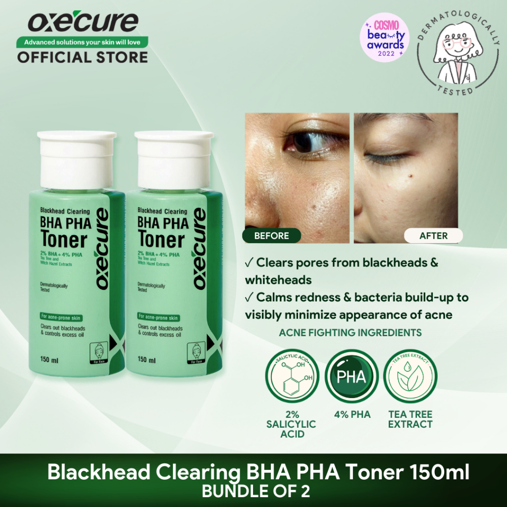 OXECURE Blackhead Clearing BHA PHA Toner 150ml Bundle of 2 | Shopee ...