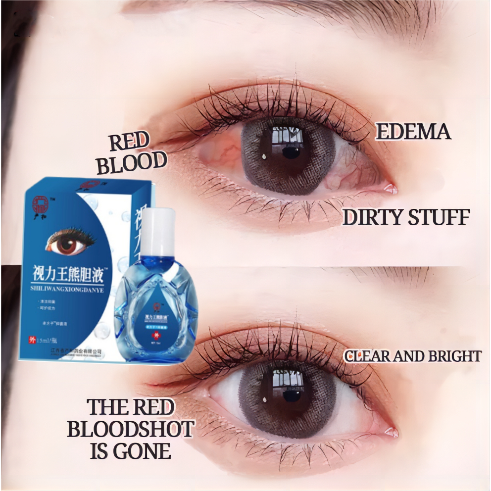 Eye Drops for Dry Eyes Clear Vision Eyes Congestion Blurry Eyes Red