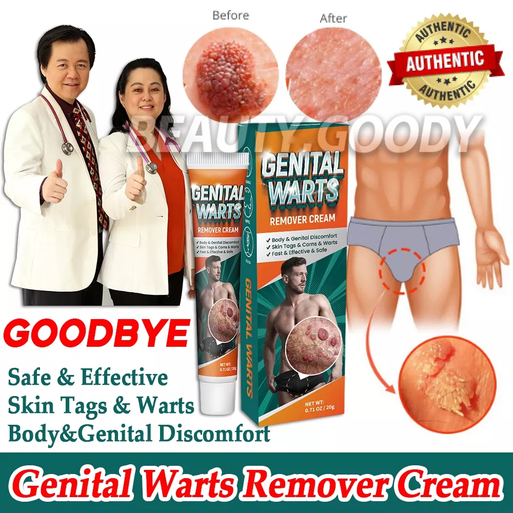 Genital Warts Remover Cream Original Herpes Genital Condyloma Skin Tag