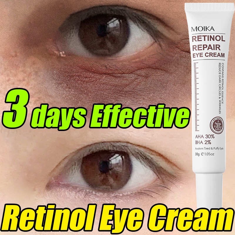 Eyebags Remover Cream Eye Care 30g Improve Dark Circles And Remove Eye ...