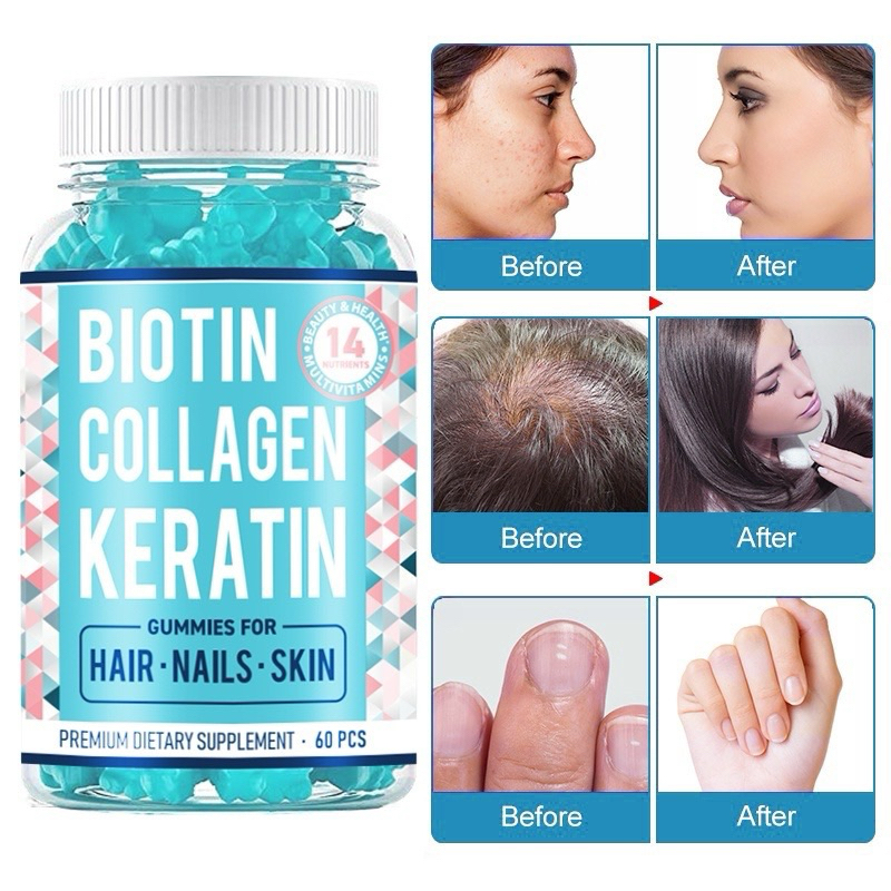 Biotin Collagen Keratin Hair Gummies Powerful Beauty Vitamin Complex ...