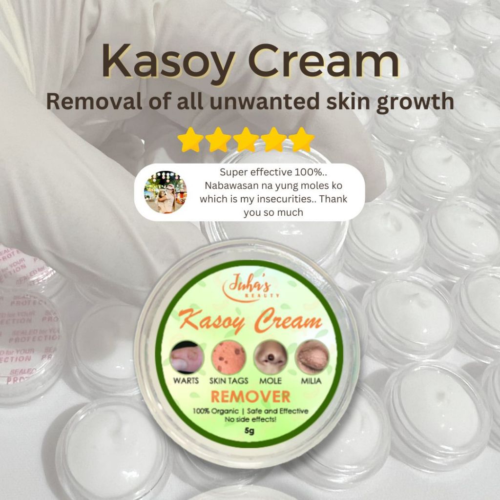 Kasoy Cream Remover | Mole Remover | Warts Remover | Skin Tag Remover ...