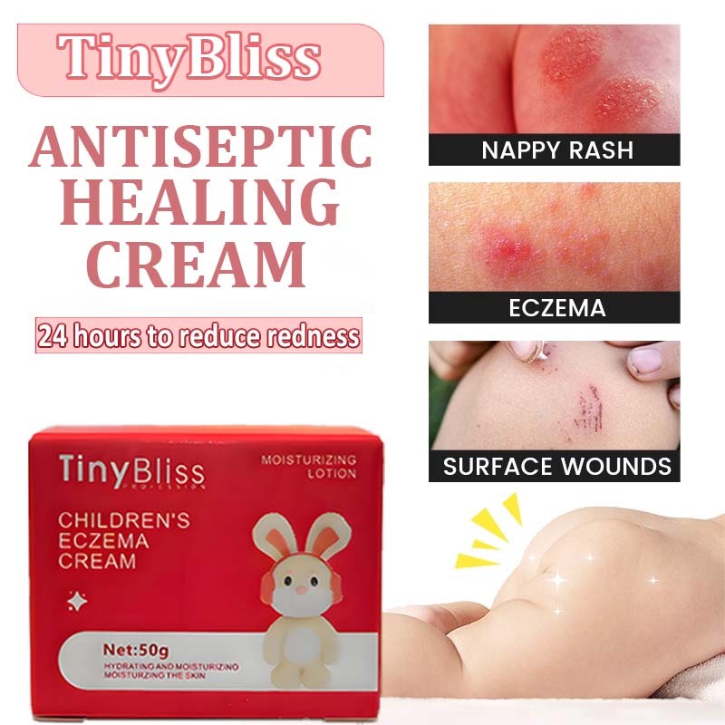 TinyBliss Baby Eczema Cream Antibacterial Itching Cream Diaperrash ...