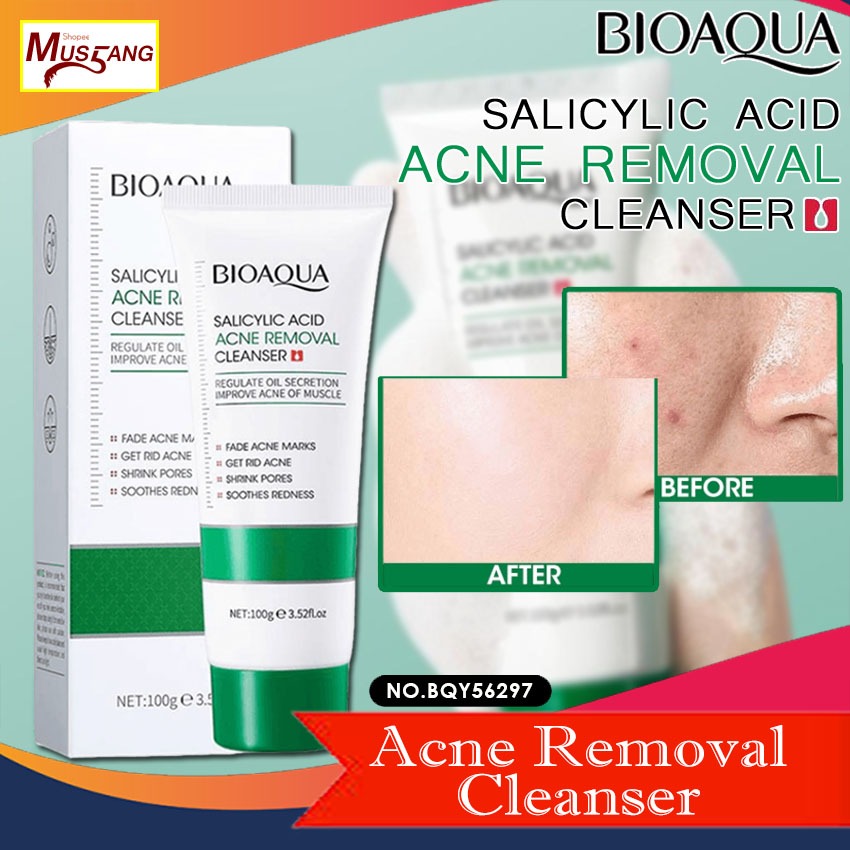 bioaqua-salicylic-acid-acne-removal-cleanser-100g-deep-cleansing-oil