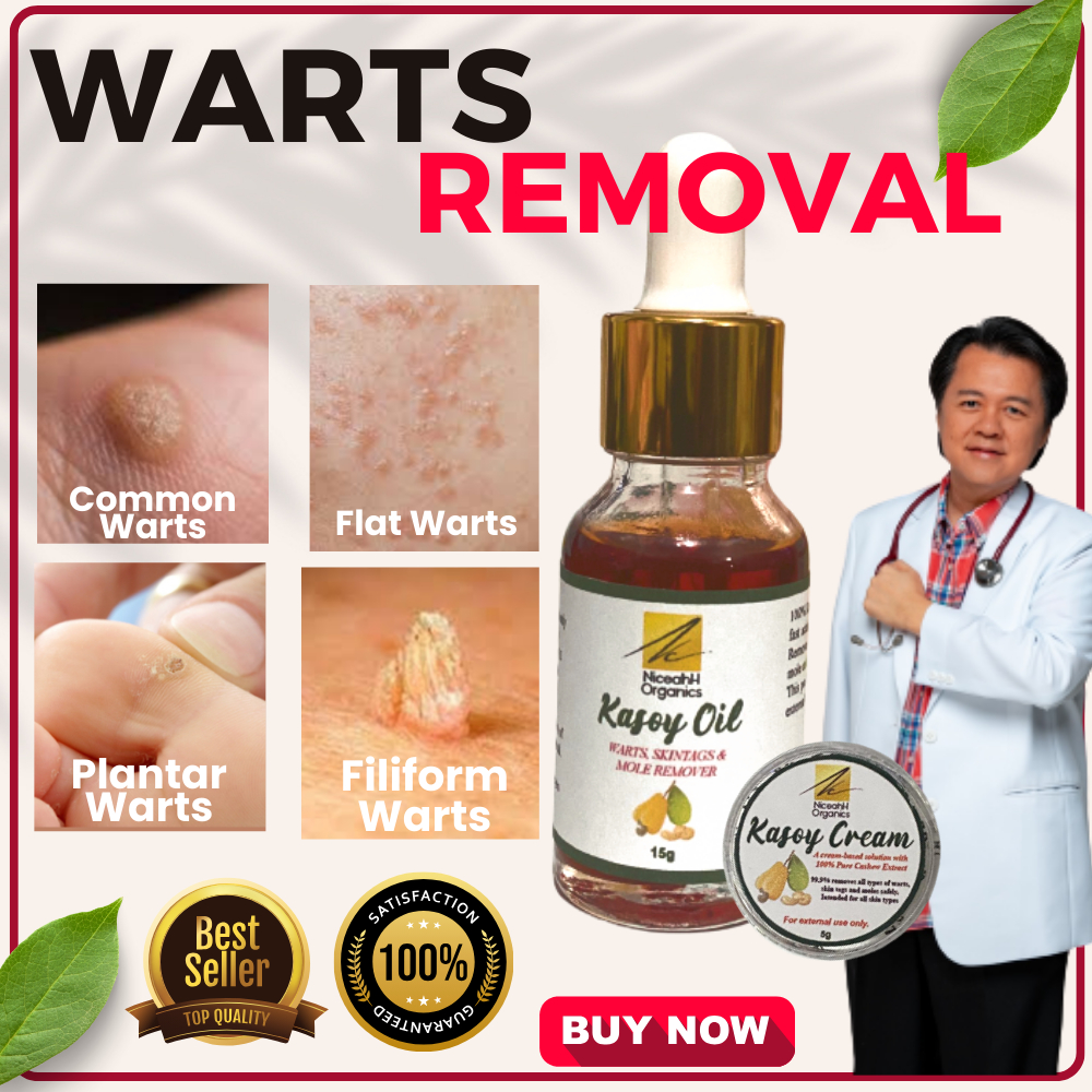 Original Kasoy Oil And Cream Powerful Warts And Kulugo Remover Genital Warts Solution Proven