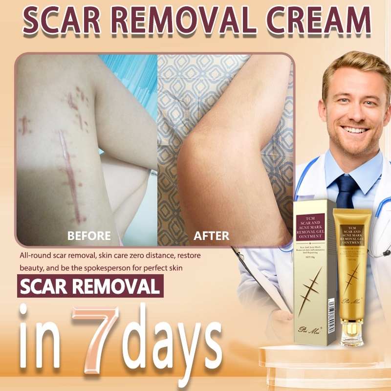 peimei scar and acne mark removal gel scar remover cream effective legs