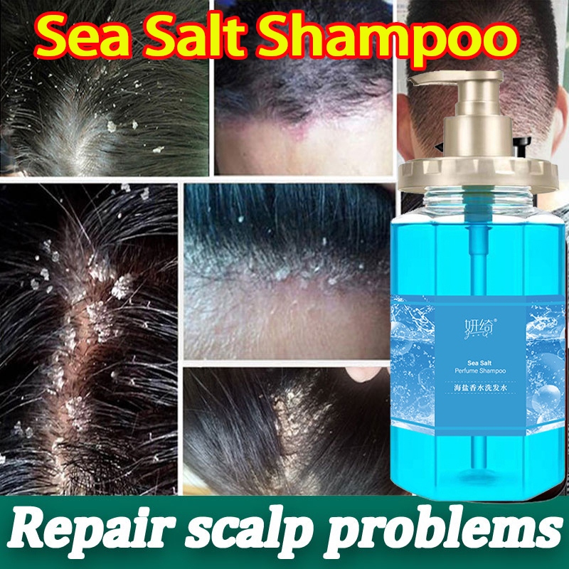 Tiktok Trend Sea Salt Shampoo Anti Dandruff Hair Treatment Itching ...