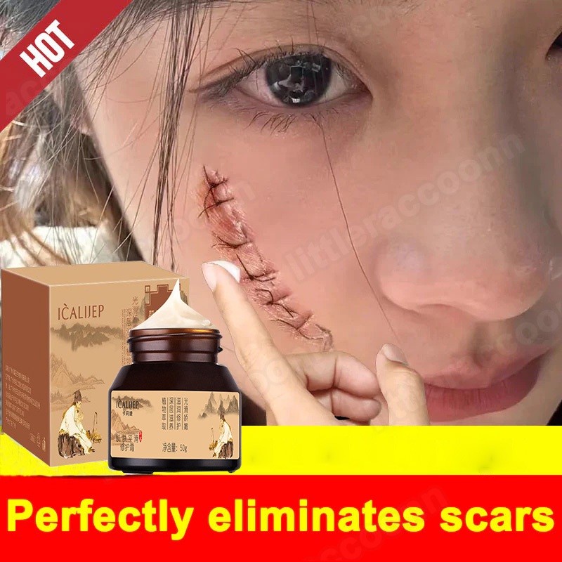 scar removal for old scar/Men and women can use scar facial repair