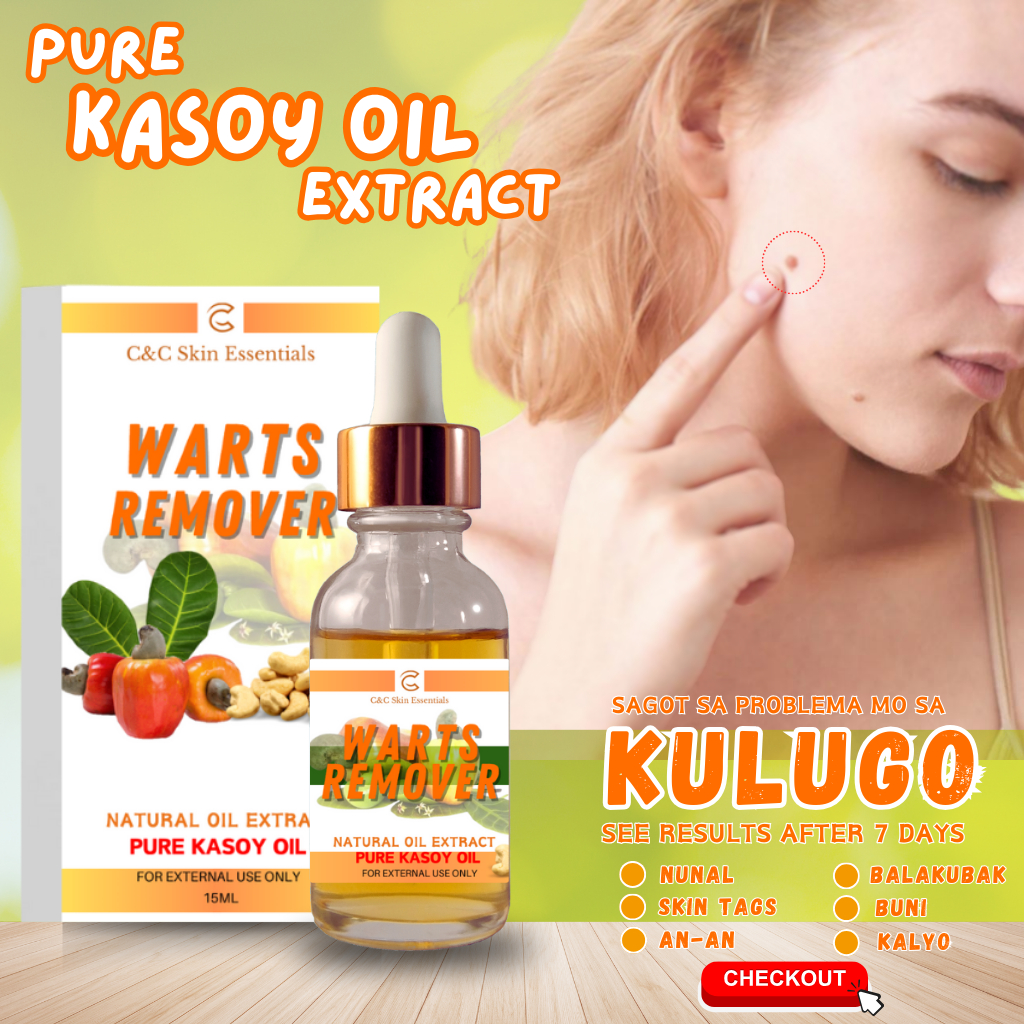 Original Pure Kasoy Oil Warts Remover Effective For Painless Removal